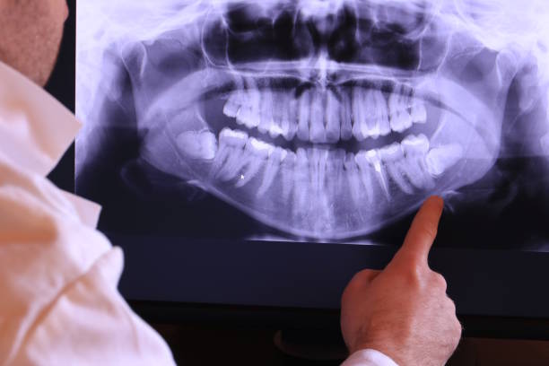 Trusted WA Emergency Dental Service Experts